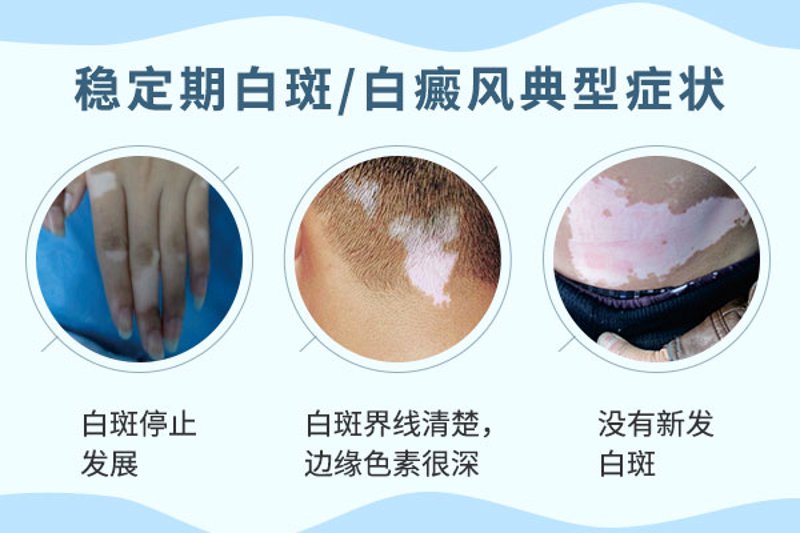 皮肤科医院选择：公立综合与专科机构的五维对比评估