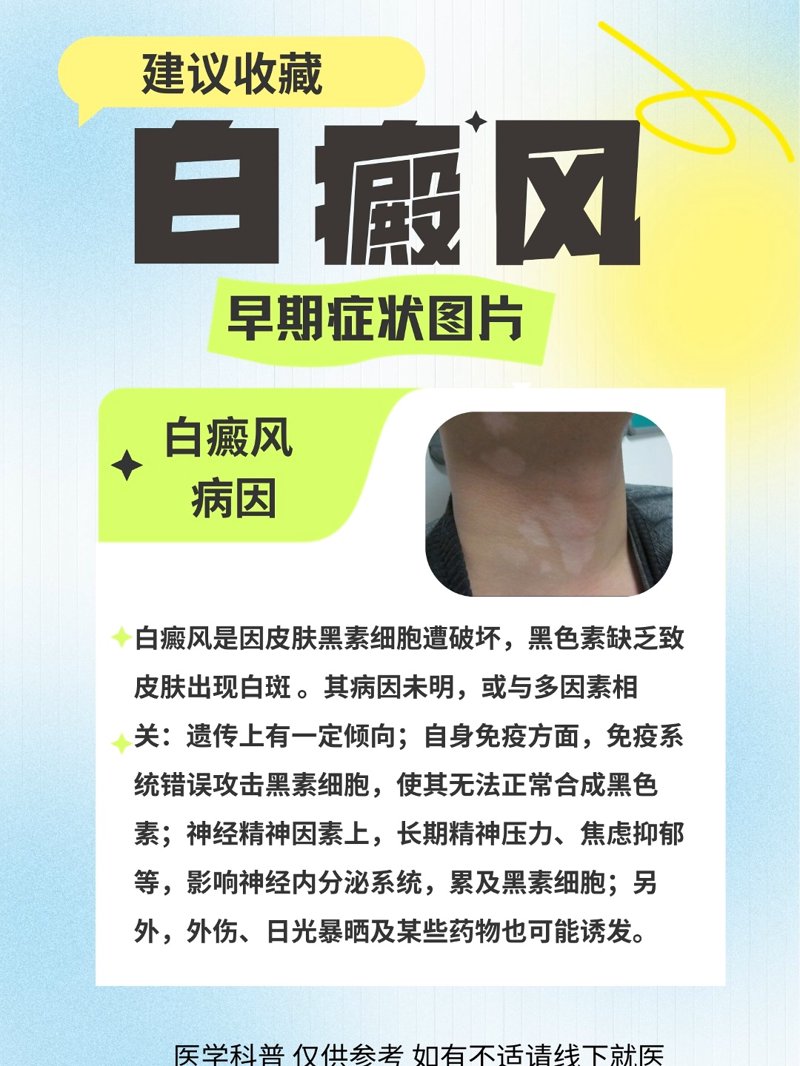 皮肤科选公立还是专科？成都患者看这三点对比就懂了