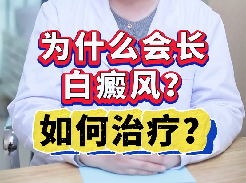 白癜风治疗