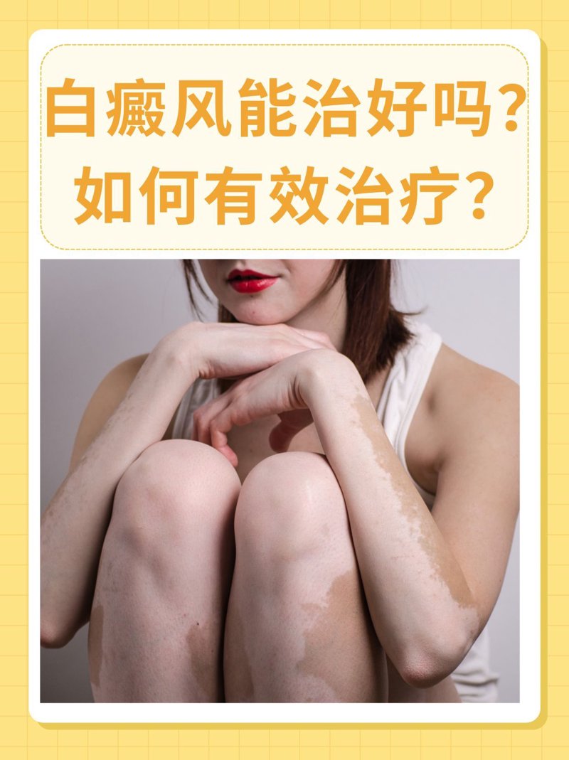 成都皮肤病医院：2026年，我眼中的公立与私立真相